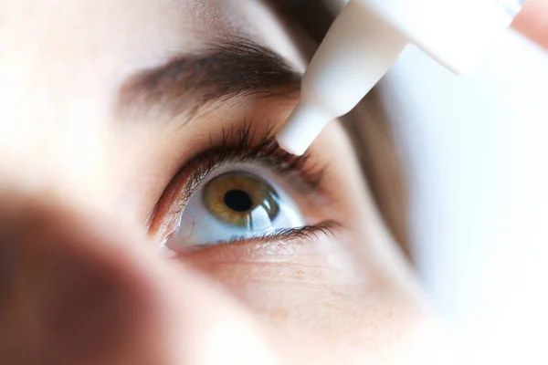 Feche até a jovem mulher aplicando colírio. A vitamina cai do cansaço e vermelhidão dos olhos. Sofrendo de olho irritado, sintomas ópticos . — Fotografia de Stock