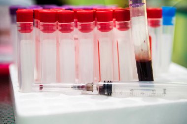 Laboratuvar teknisyeni laboratuvarda bir kan örneğini analiz ediyor. Tıbbi, farmasötik ve bilimsel araştırma ve geliştirme kavramı 