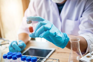 Laboratuvar teknisyeni laboratuvarda bir kan örneğini analiz ediyor. Tıbbi, farmasötik ve bilimsel araştırma ve geliştirme kavramı 