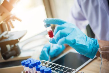 Laboratuvar teknisyeni laboratuvarda bir kan örneğini analiz ediyor. Tıbbi, farmasötik ve bilimsel araştırma ve geliştirme kavramı 