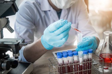 Laboratuvar teknisyeni laboratuvarda bir kan örneğini analiz ediyor. Tıbbi, farmasötik ve bilimsel araştırma ve geliştirme kavramı 