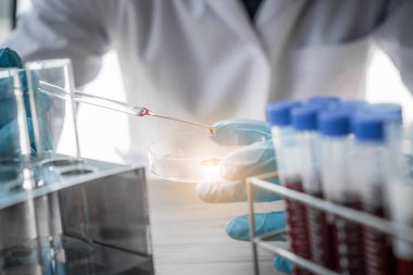 Laboratuvar teknisyeni laboratuvarda bir kan örneğini analiz ediyor. Tıbbi, farmasötik ve bilimsel araştırma ve geliştirme kavramı
