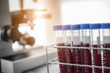 Laboratuvar laboratuarında test tüpündeki kan örneğini analiz ediyor. Tıbbi, farmasötik ve bilimsel araştırma ve geliştirme kavramı