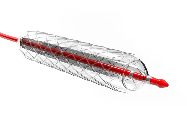 Stent Ballon Auf Weißem Hintergrund Illustration — Stockfoto