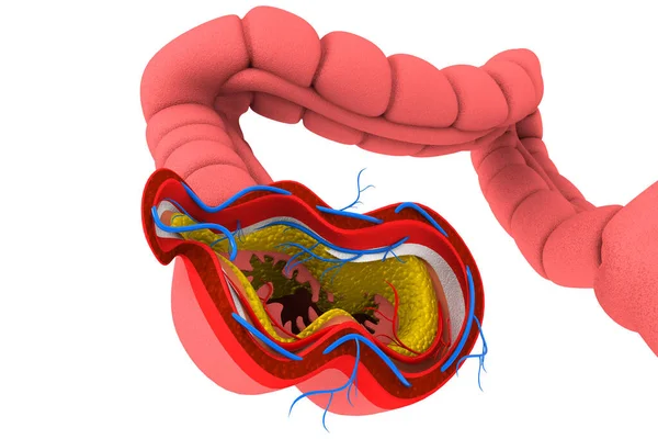 Anatomia Del Colon Sfondo Bianco Illustrazione — Foto Stock