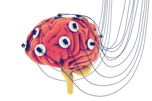 Poder Mente Humana Concepto Análisis Cerebral Cerebro Conectado Los Cables —  Fotos de Stock