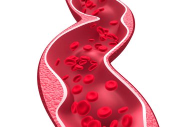 Arterde kolesterol plağı var. 3d illüstrasyon