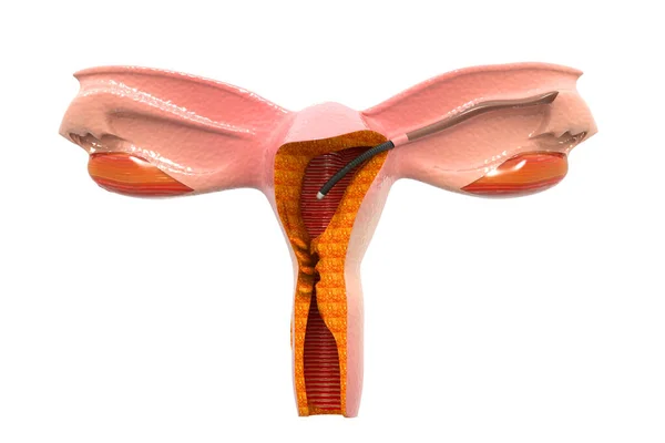 Sistema Reproductivo Femenino Tubo Falopio Renderizar — Foto de Stock