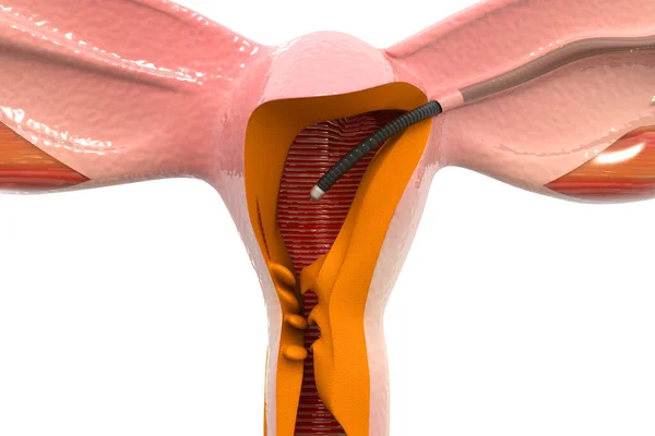 女性生殖系统 输卵管 3D渲染 — 图库照片