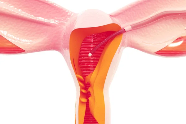 Sistema Reproductivo Femenino Tubo Falopio Renderizar —  Fotos de Stock