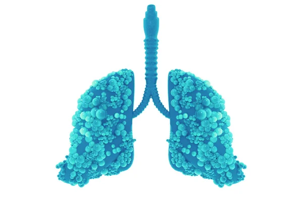 Lungs Disease Illustration — Stock Photo, Image