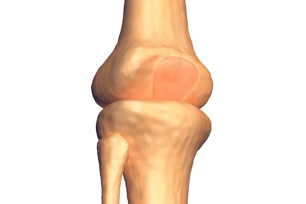人間の膝関節 3Dレンダリング — ストック写真