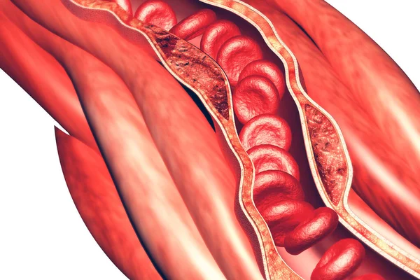 Células Sanguíneas Uma Renderização Artery — Fotografia de Stock