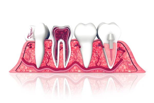 Dente Humano Secção Transversal — Fotografia de Stock