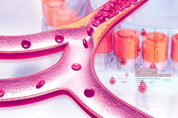 Placca Colesterolo Nell Arteria Illustrazione — Foto Stock