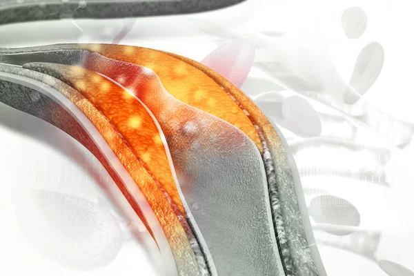 Arterde kolesterol plağı var. 3d illüstrasyon