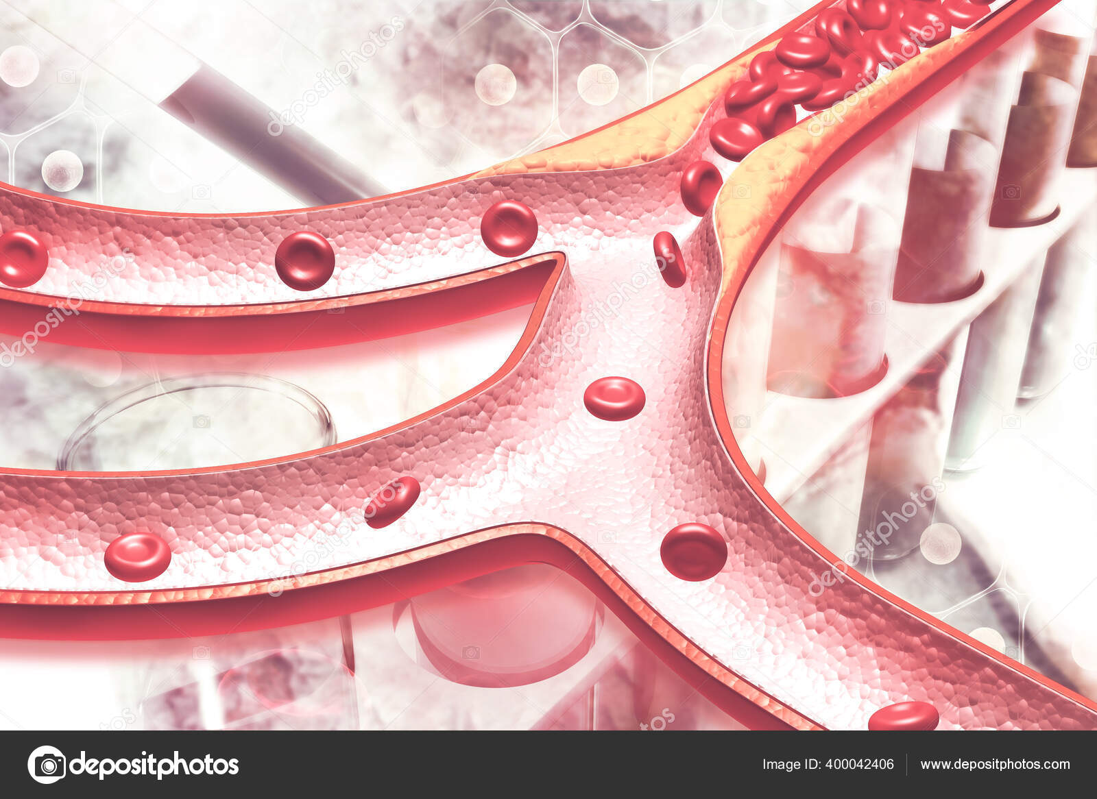 Cholesterol Plaque Artery Illustration Stock Photo by ©crytallight 400042406