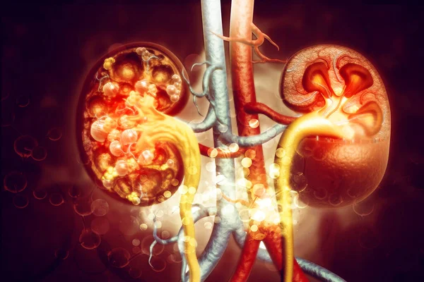 Doença Renal Ilustração — Fotografia de Stock