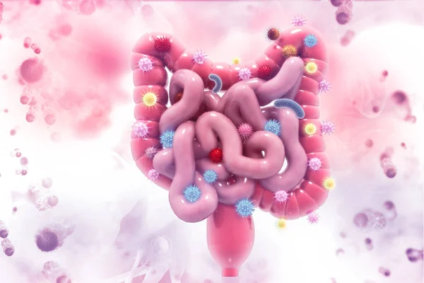 Colonkanker Kanker Valt Cellen Aan Concept Darmziekte Illustratie — Stockfoto