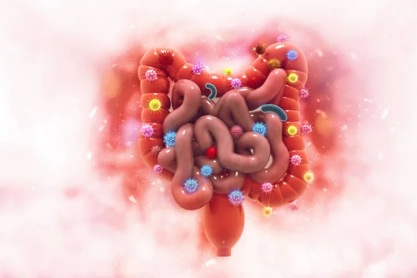 Colon cancer. Cancer attacking cells. Colon disease concept. 3d illustration