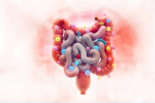 Cáncer Colon Cáncer Atacando Células Concepto Enfermedad Colon Ilustración — Foto de Stock