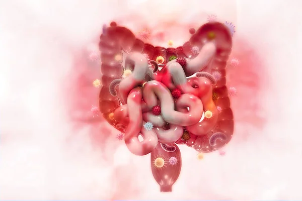 結腸がん 癌細胞を攻撃する コロン病の概念 3Dイラスト — ストック写真