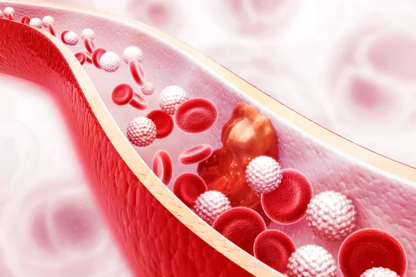Tablica Cholesterolu Tętnicy Tle Naukowym Ilustracja — Zdjęcie stockowe