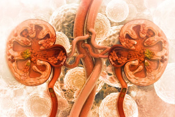 Doença Renal Section Ilustração Transversal — Fotografia de Stock