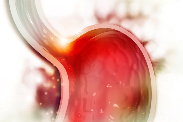 Cholesterol Plaque Artery Stomach Cross Section Illustration — Stock Photo, Image