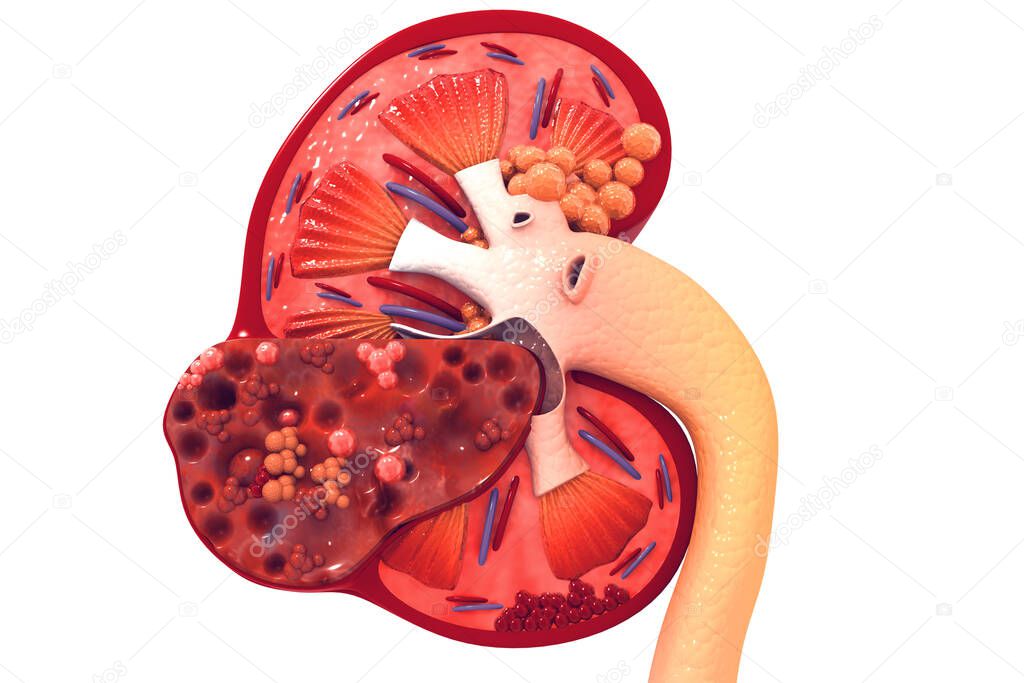 Human kidney cross section