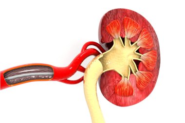 Stent anjiyoplasti. Çevresel arter hastalığı
