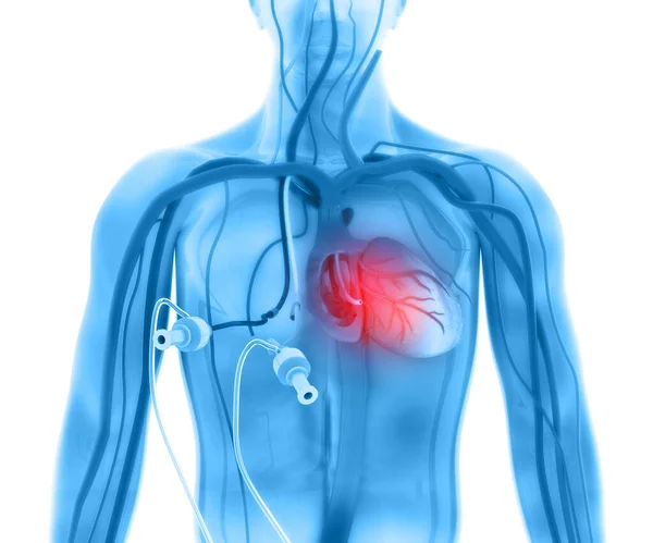 Dialyseproces Illustratie — Stockfoto