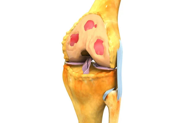 人間の膝関節の解剖学 3Dイラスト — ストック写真
