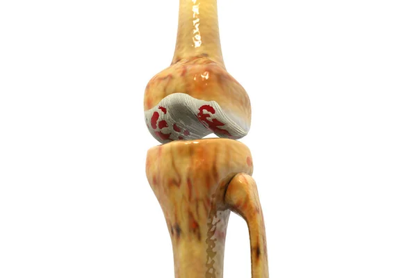Anatomy Human Knee Joint Illustration — Stock Photo, Image