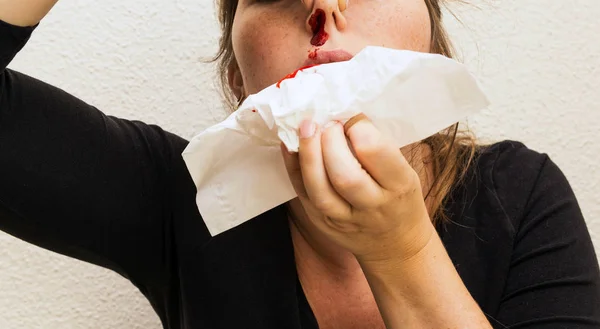 Blessure saignement de nez, saignement de nez chez la femme, lésions au nez sang et tissus — Photo