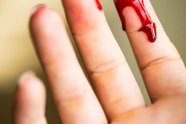 Parmak kesimi, bıçakla yaralanan kanama, elinde kan yarası
