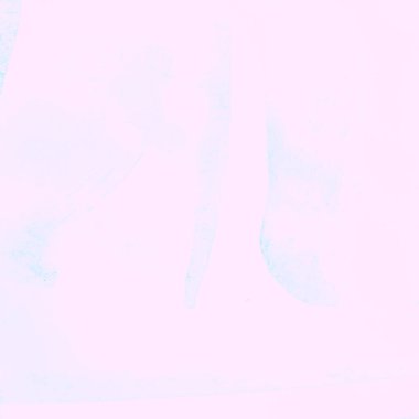 İmdat Hattı Düzeni. Eğri Violet Doğrusal 