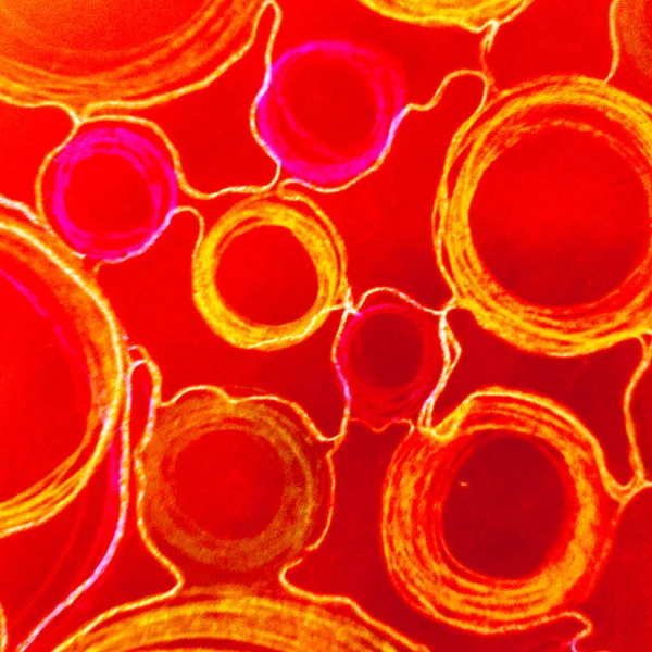 Прозрачные раковые клетки. Раунд микробиологии — стоковое фото