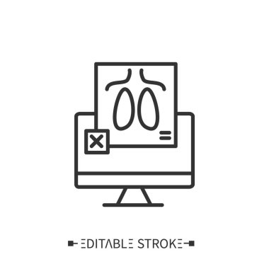 Bilgisayarlı florografi. Ciğerler inceleniyor. Düzenlenebilir vektör illüstrasyonu 