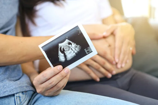 Anne ve babanın elinde ultrason fotoğrafı var. Annem ve babam ceninlerinin ultrason görüntülerini gösteriyorlar. Kalp şeklinde bir el. Yeni doğan.