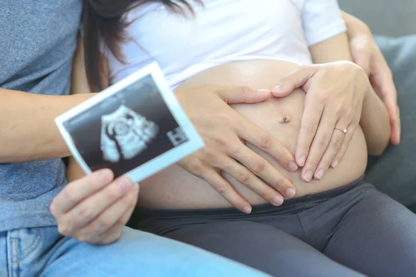 Matka Otec Drží Fotku Ultrazvuku Máma Tátou Předvádějí Ultrazvukové Snímky — Stock fotografie