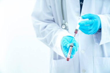 Doktor El deney tüpünü tutuyor. Coronavirus (COVID-19) adlı Asyalı doktor laboratuvarda kan örneği tüpü ve nCoV-19 klasörü tutuyor. Seçici odak.