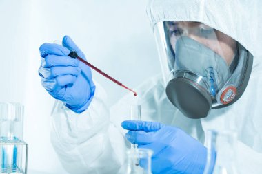 Bilim adamları virüsü aramak için laboratuardaki cam bir tüpün içine kan döküyorlar..