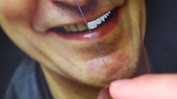 デジタル技術 Cad Cam システム 歯補綴の前後に 笑みを浮かべて男 歯科の診療 これは スマイル デザイン — ストック動画