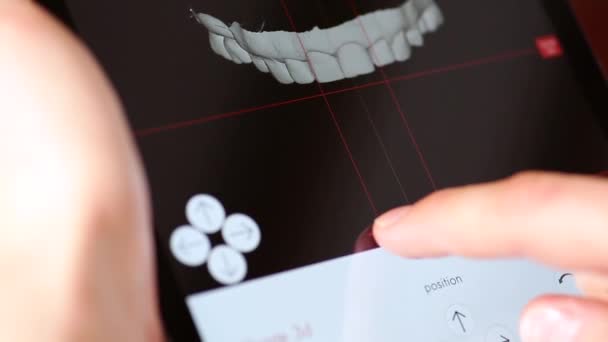 45,633 Dental Videos, Royalty-free Stock Dental Footage | Depositphotos