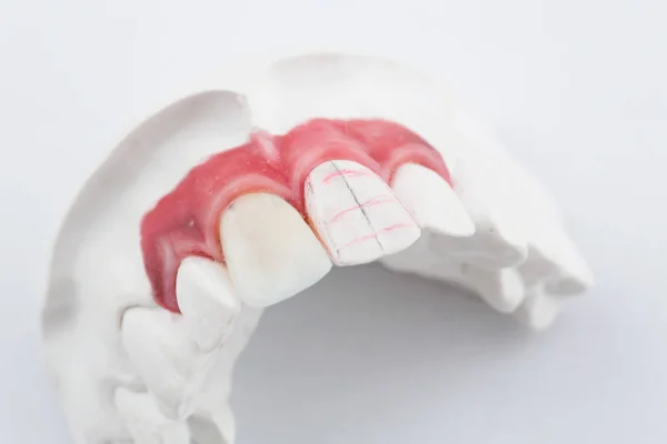 Detail Dental Wax Model Ower White Background — Stock Photo, Image