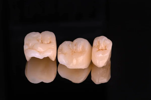 Chapas Coronas Dentales Cerámica — Foto de Stock