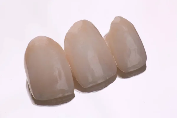 Dental ceramic veneers and crowns isolated with mirror background. — Stock Photo, Image