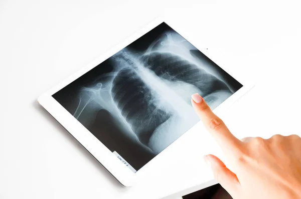 Médecin Examinant Pointant Les Résultats Des Rayons Pulmonaires Sur Tablette — Photo