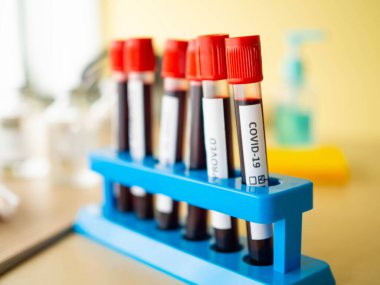 Aşı ve şırınga. Tıbbi bulaşıcı konsept. Coronavirus 2019 nCoV kan örneği. Aşı şişesi doz grip iğnesi şırınga, tıbbi konsept.